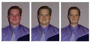 Nip and tuck advanced.